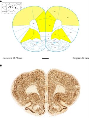 Parvalbumin interneuron deficiency in the prefrontal and motor cortices of spontaneously hypertensive rats: an attention-deficit hyperactivity disorder animal model insight